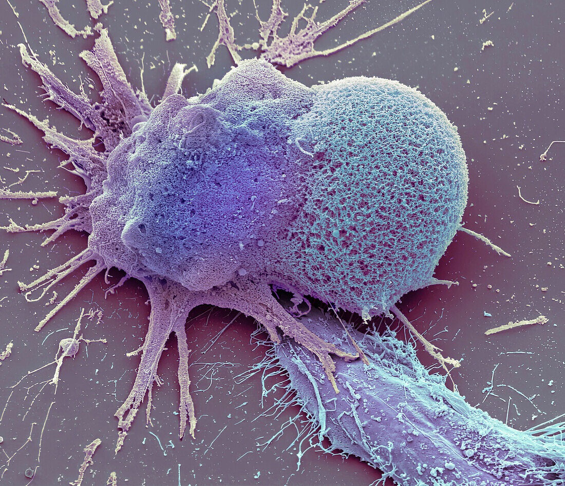Chemotherapy induced cell death, SEM