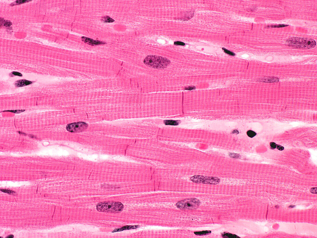 Heart muscle, light micrograph