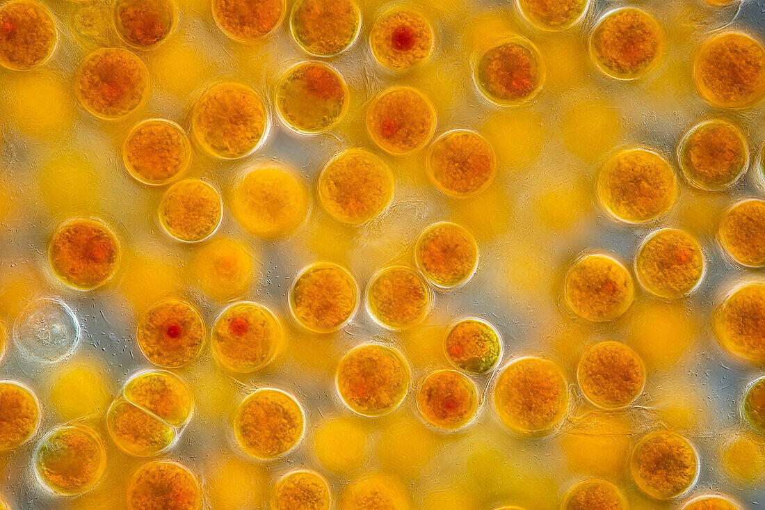 Nottbeckia ochracea algae, light micrograph