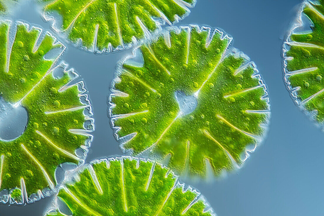 Micrasterias thomasiana var. notata algae, light micrograph