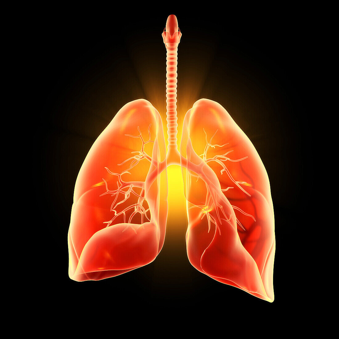 Human lungs, pneumonia, illustration