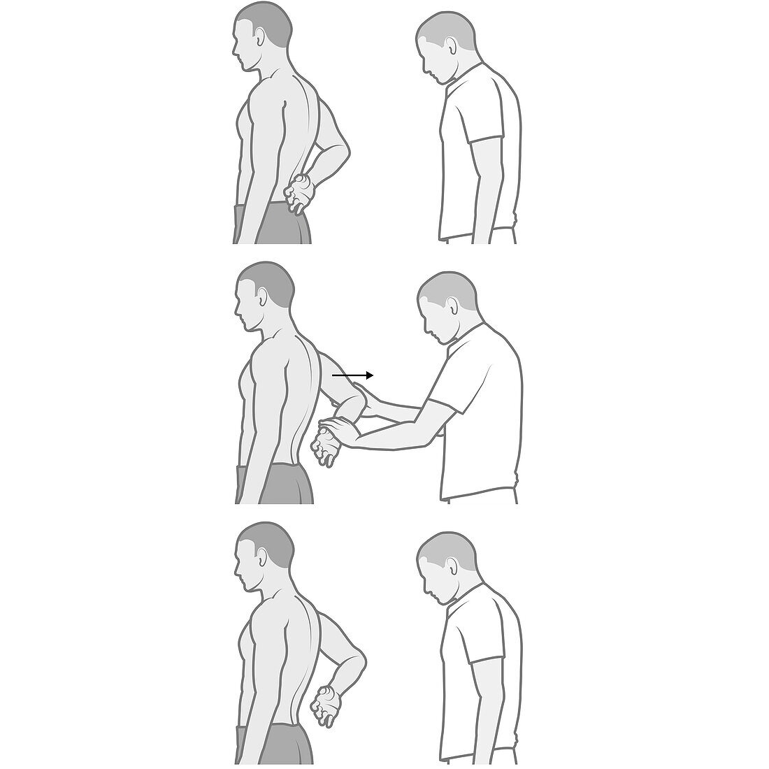 Shoulder examination, illustration