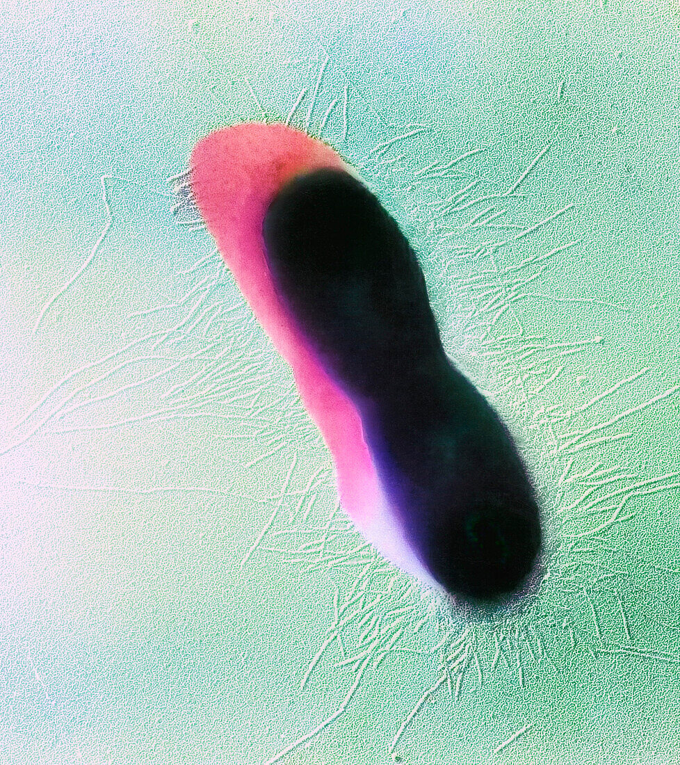 Shadowcast rod bacterium, TEM