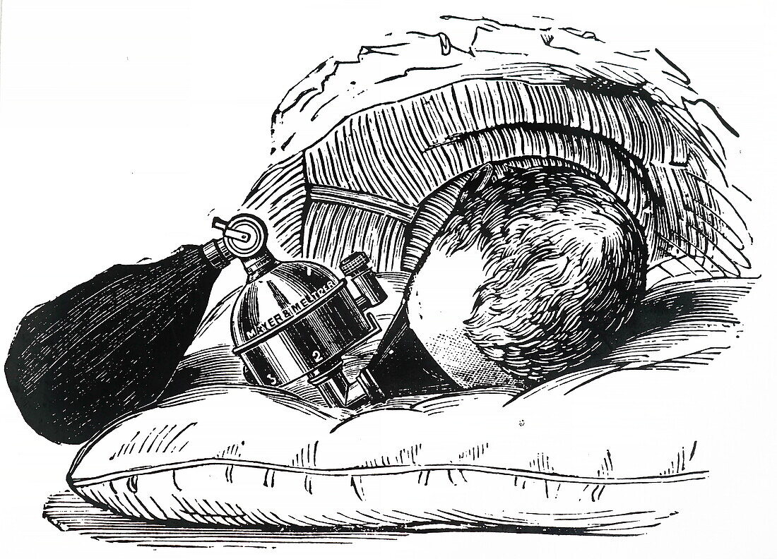 Charles Sheppard's angular adjuster, illustration