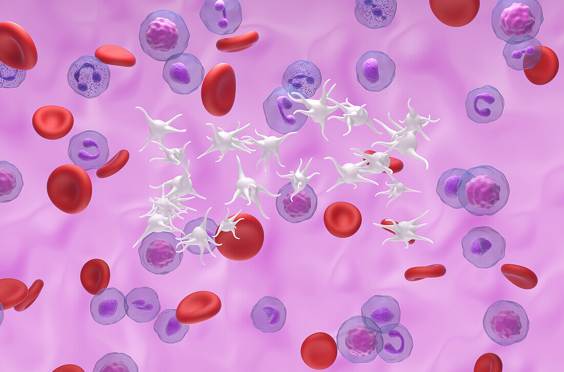 Essential thrombocythaemia, illustration