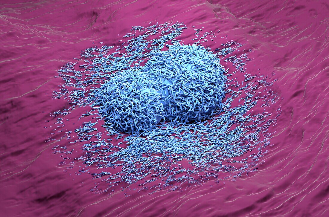 Liver cancer cells, illustration