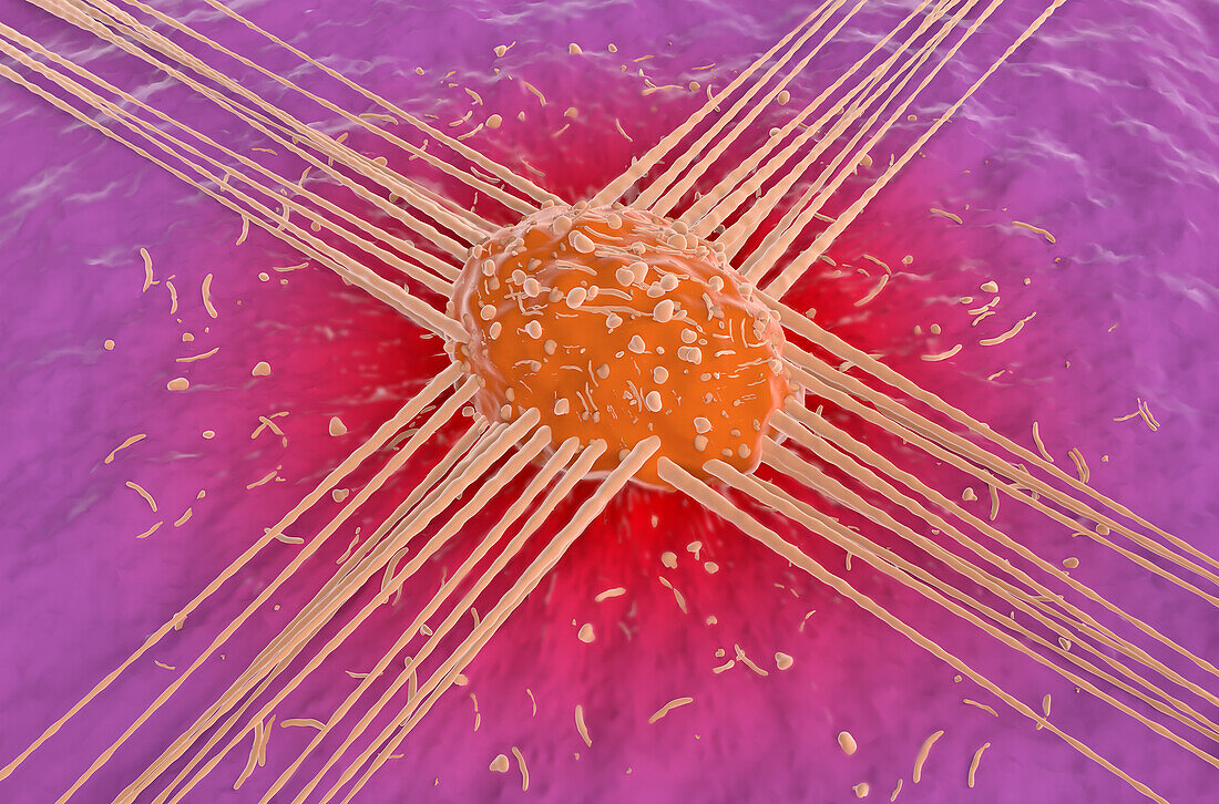Mouth cancer cell, illustration