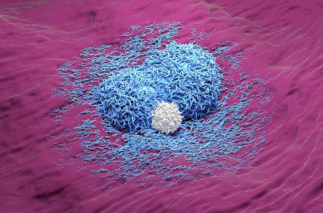 T cell attacking liver cancer cells, illustration