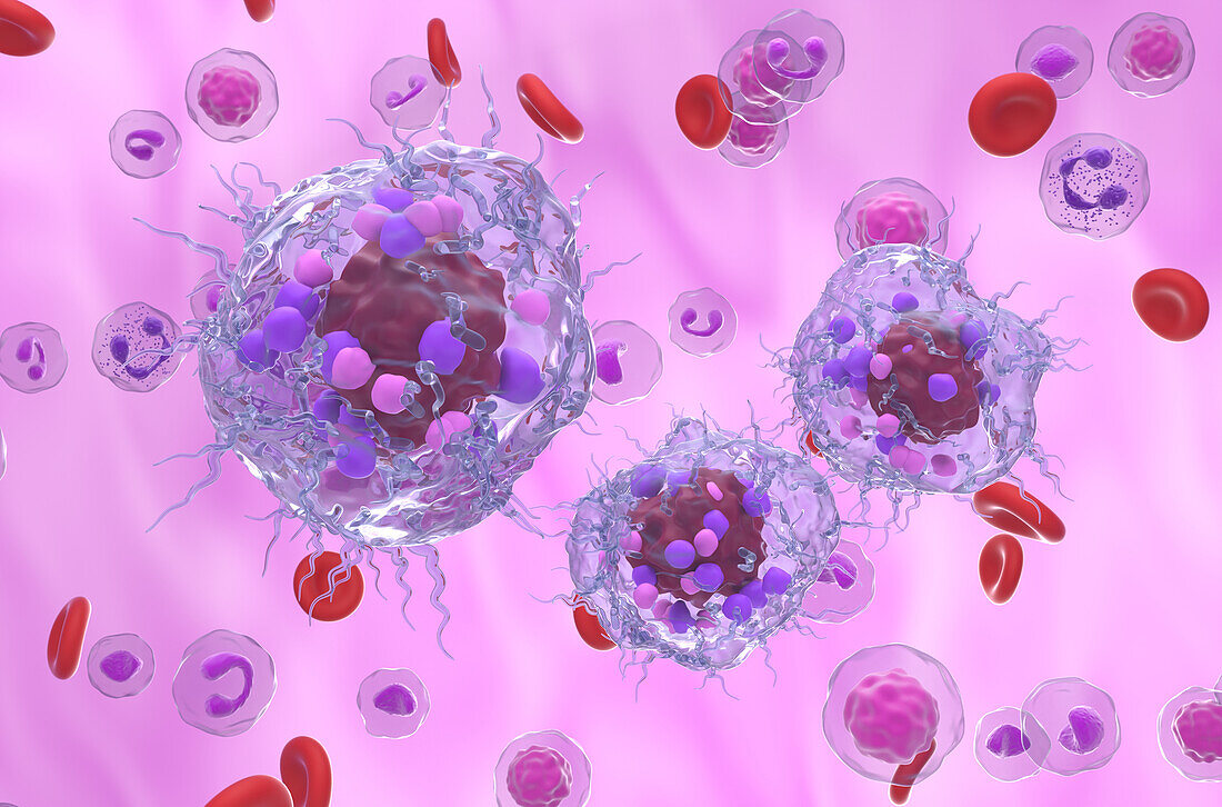 Neuroendocrine tumour cells, illustration