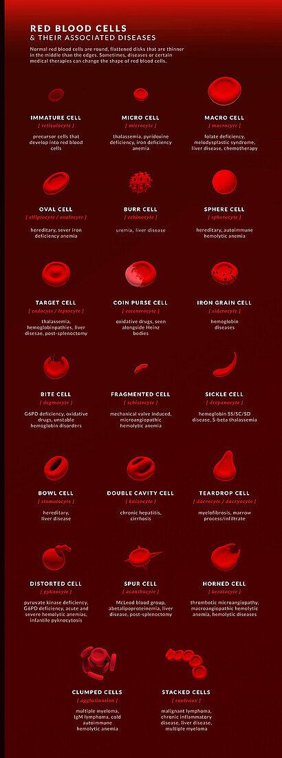 Forms of abnormal red blood cell, illustration