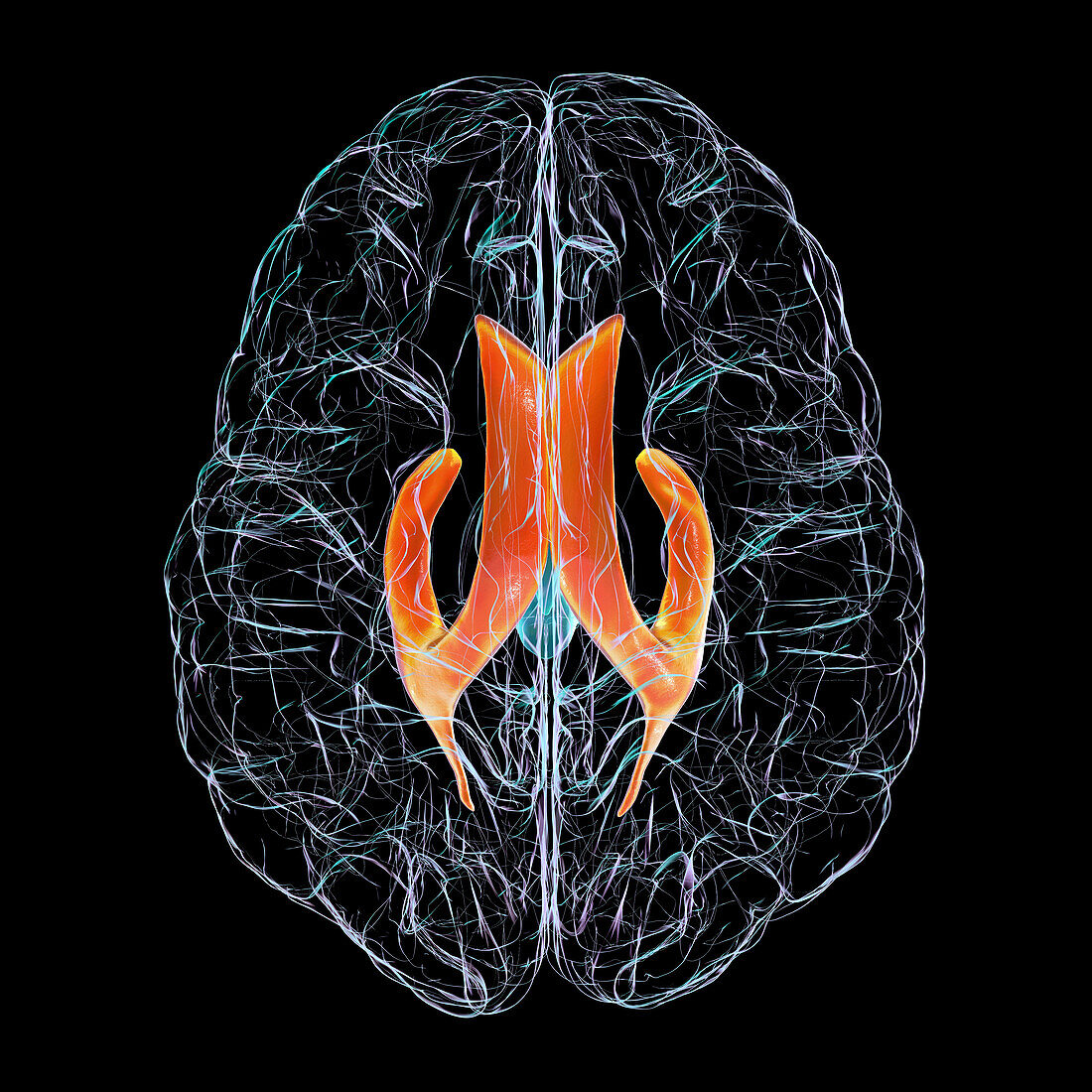 Lateral brain ventricles, illustration