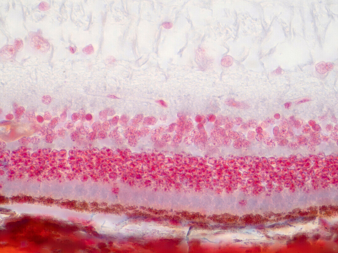 Human retina tissue, light micrograph