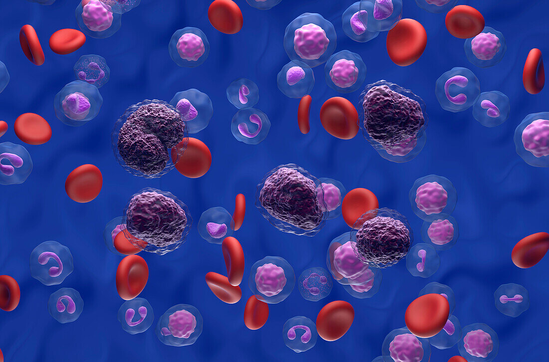 Non-Hodgkin's lymphoma cells, illustration
