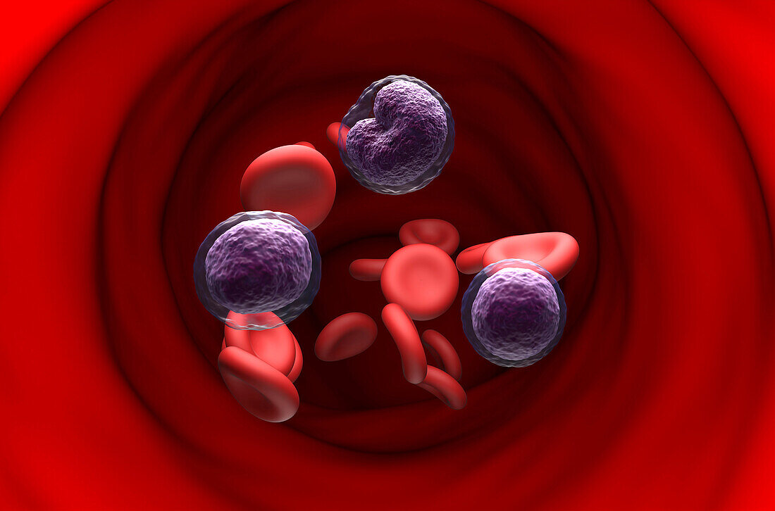 Non-Hodgkin's lymphoma cells, illustration