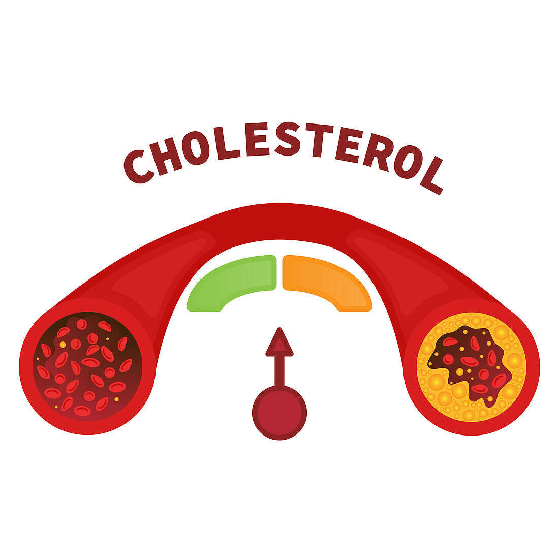 Cholesterol levels, conceptual illustration