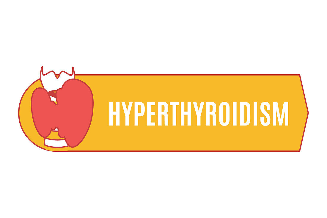 Hyperthyroidism, conceptual illustration