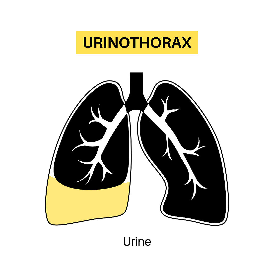 Urinothorax, illustration