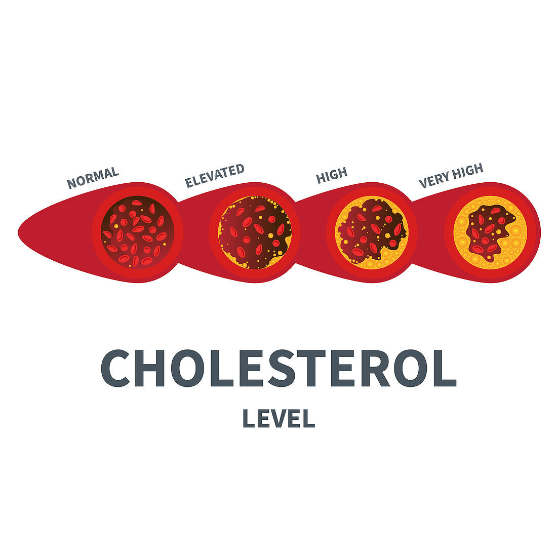 Cholesterol, conceptual illustration
