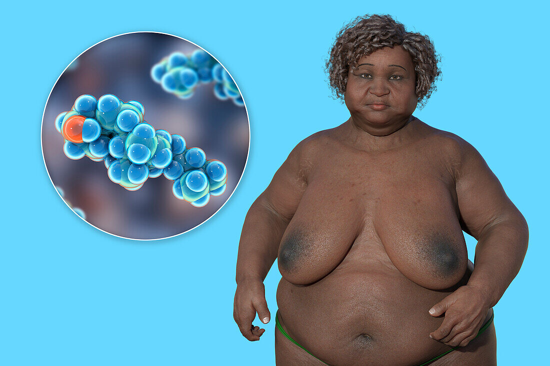 Overweight woman and cholesterol molecules, illustration