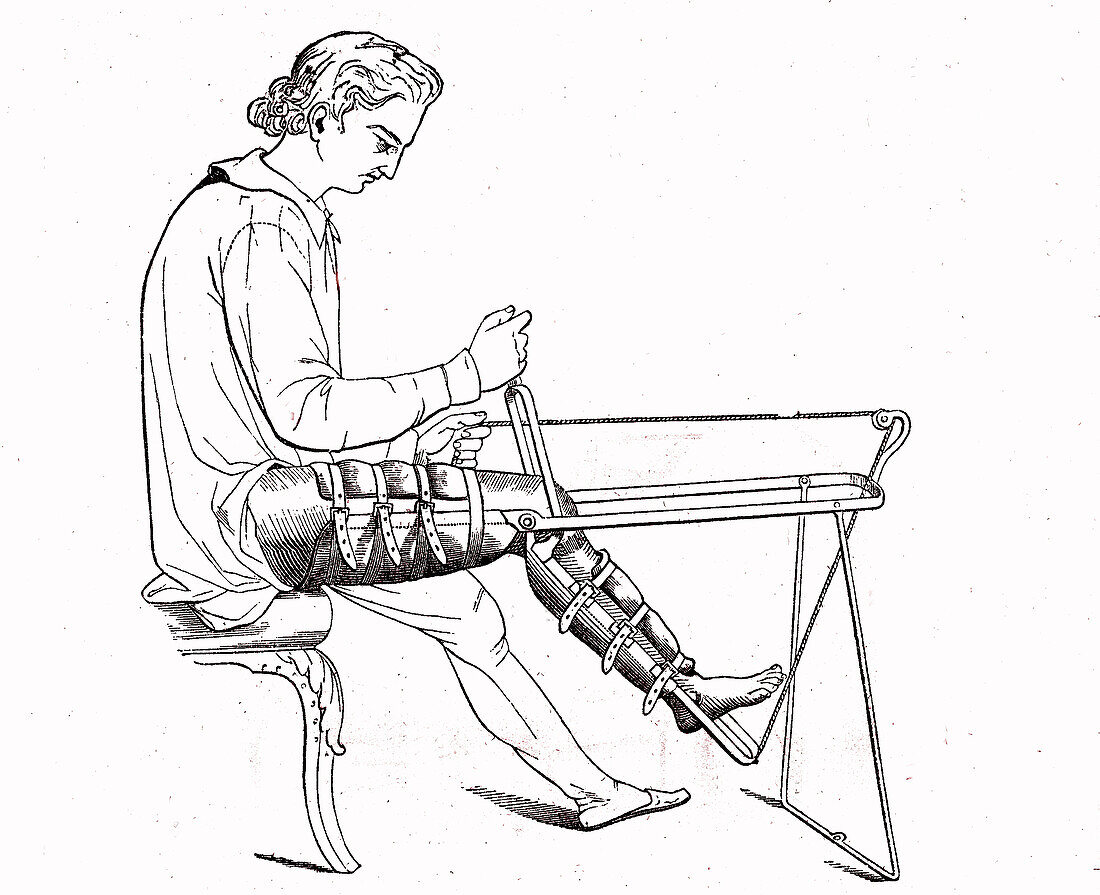 Device for flexion and extension of the leg, 19th century illustration