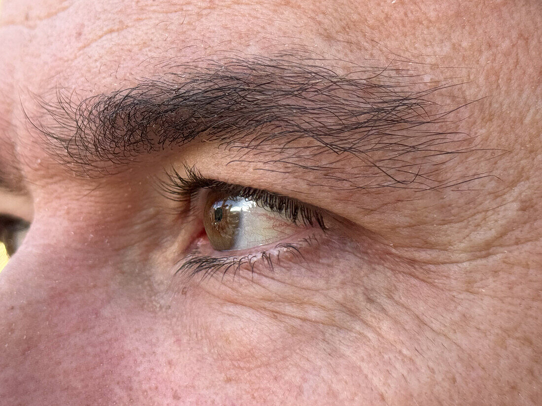 Close up photo of the eye of a 47 year old man