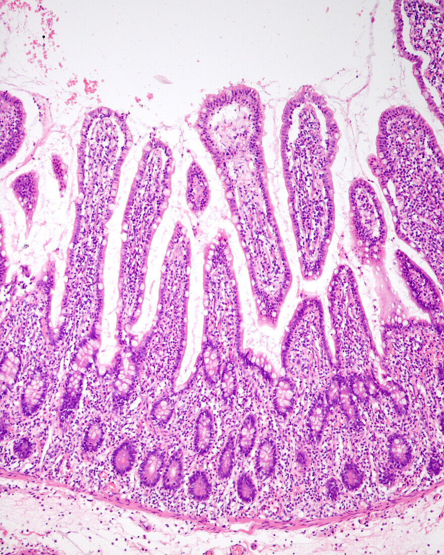 Mucosa of the ileum, light micrograph