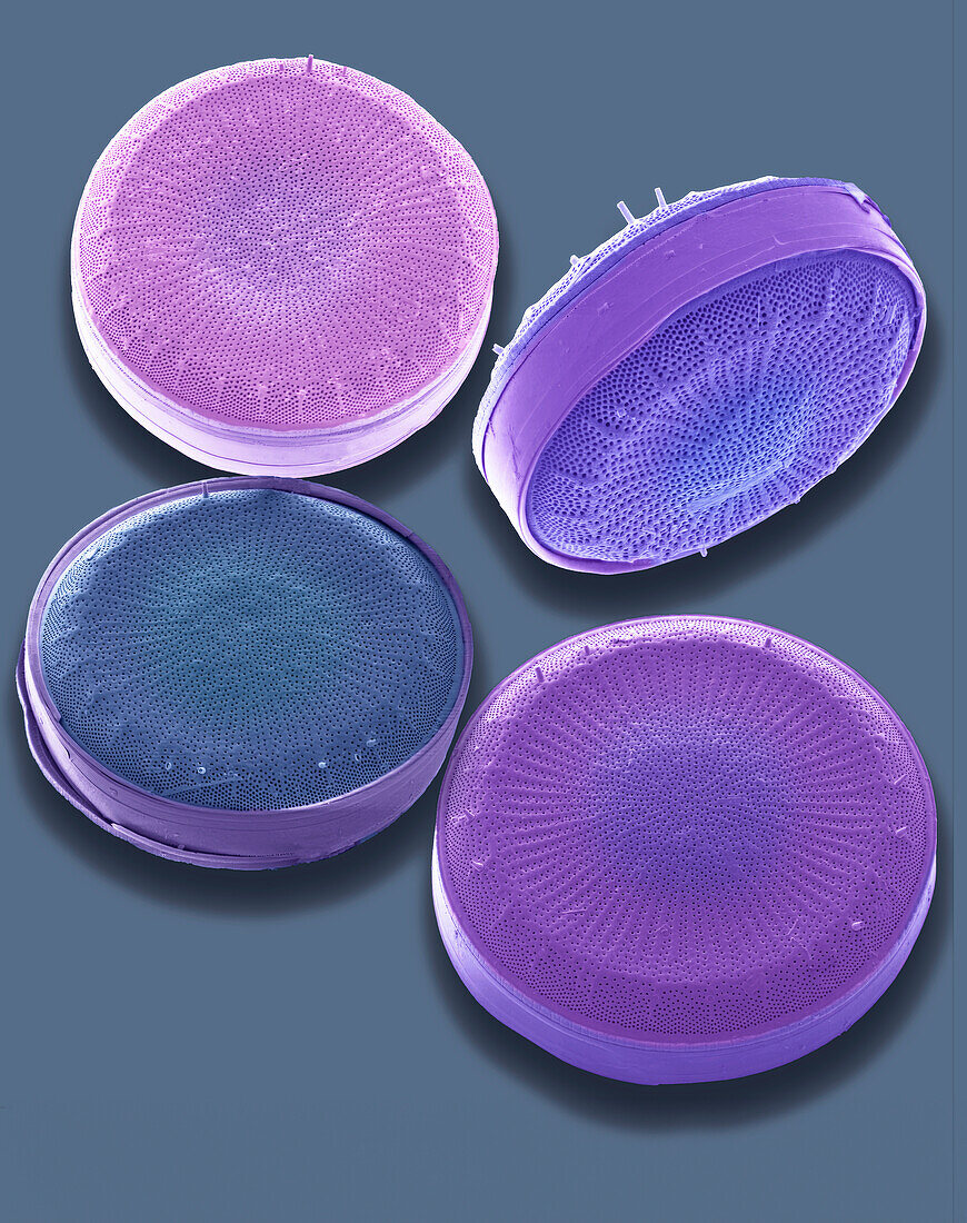 Diatoms, SEM