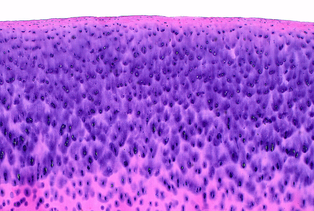 Articular cartilage, light micrograph