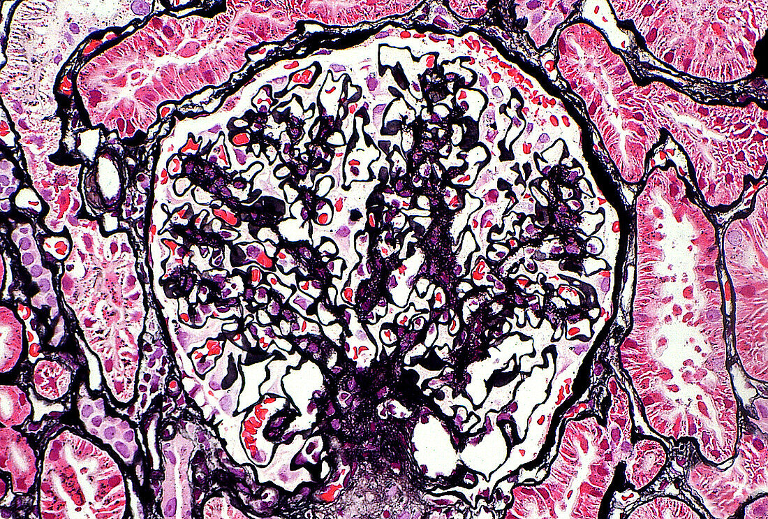 Kidney glomerulus, light micrograph