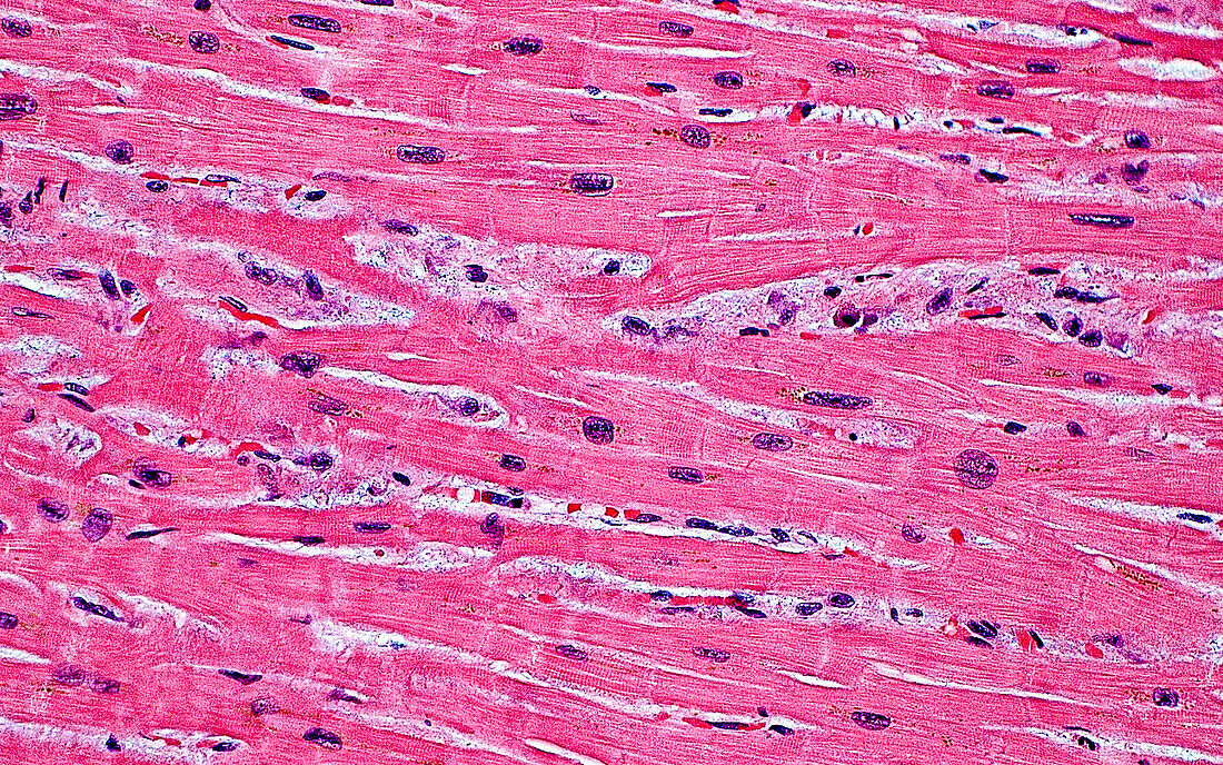 Heart muscle cells, light micrograph