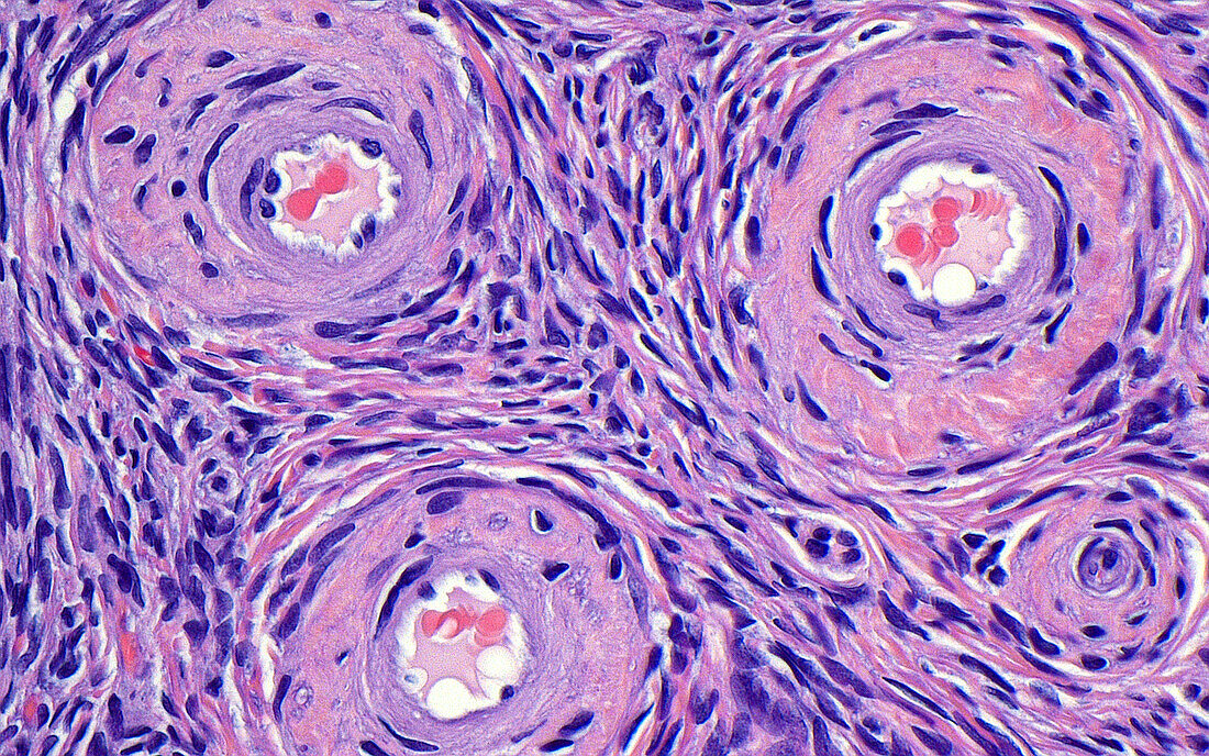 Ovary stroma and blood vessels, light micrograph