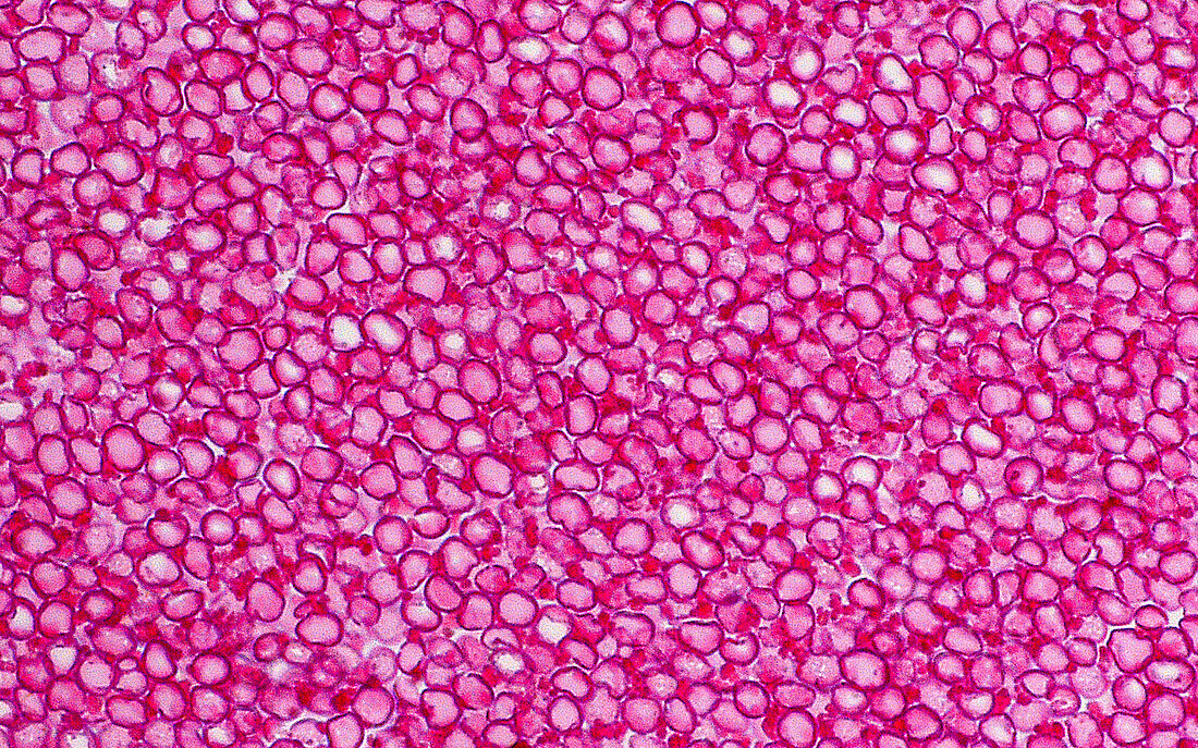 Red blood cells, light micrograph