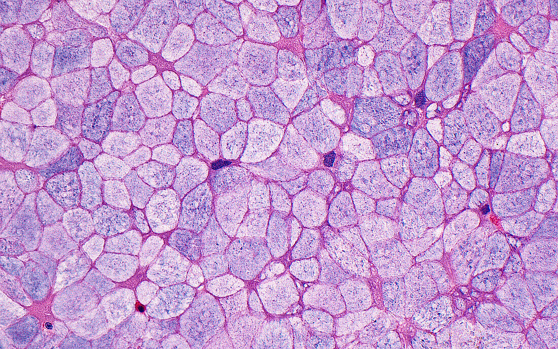 Sinus respiratory epithelium cells, light micrograph