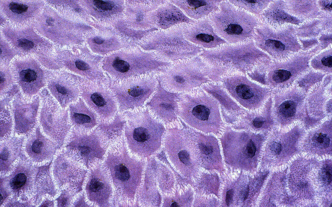 Squamous cells, light micrograph