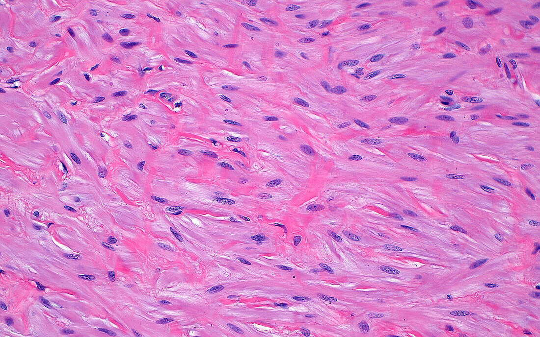 Vas deferens smooth muscle, light micrograph