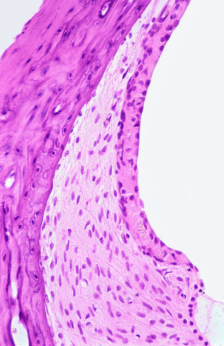 Cochlear duct, light micrograph