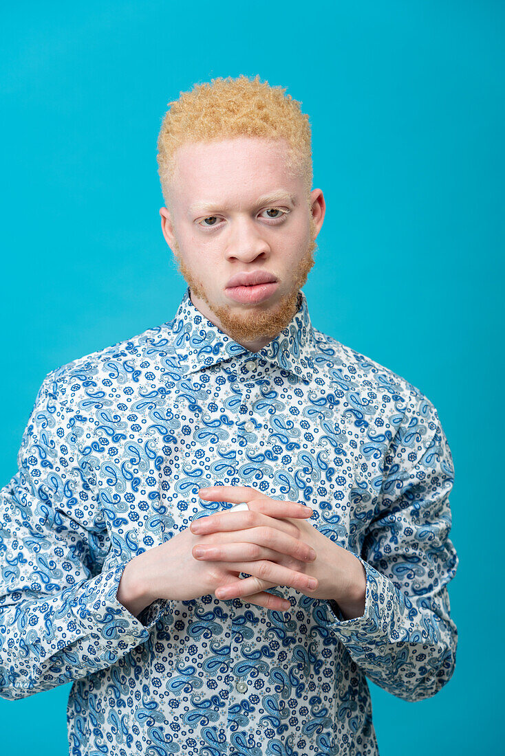 Studio portrait of albino man in blue patterned shirt