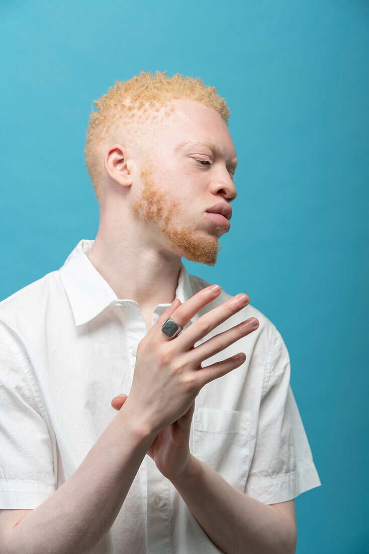 Studio portrait of albino man in white shirt