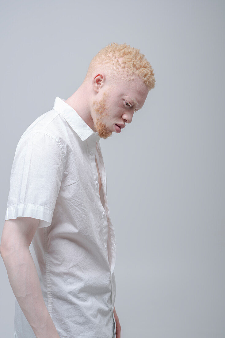 Studio portrait of albino man in white shirt