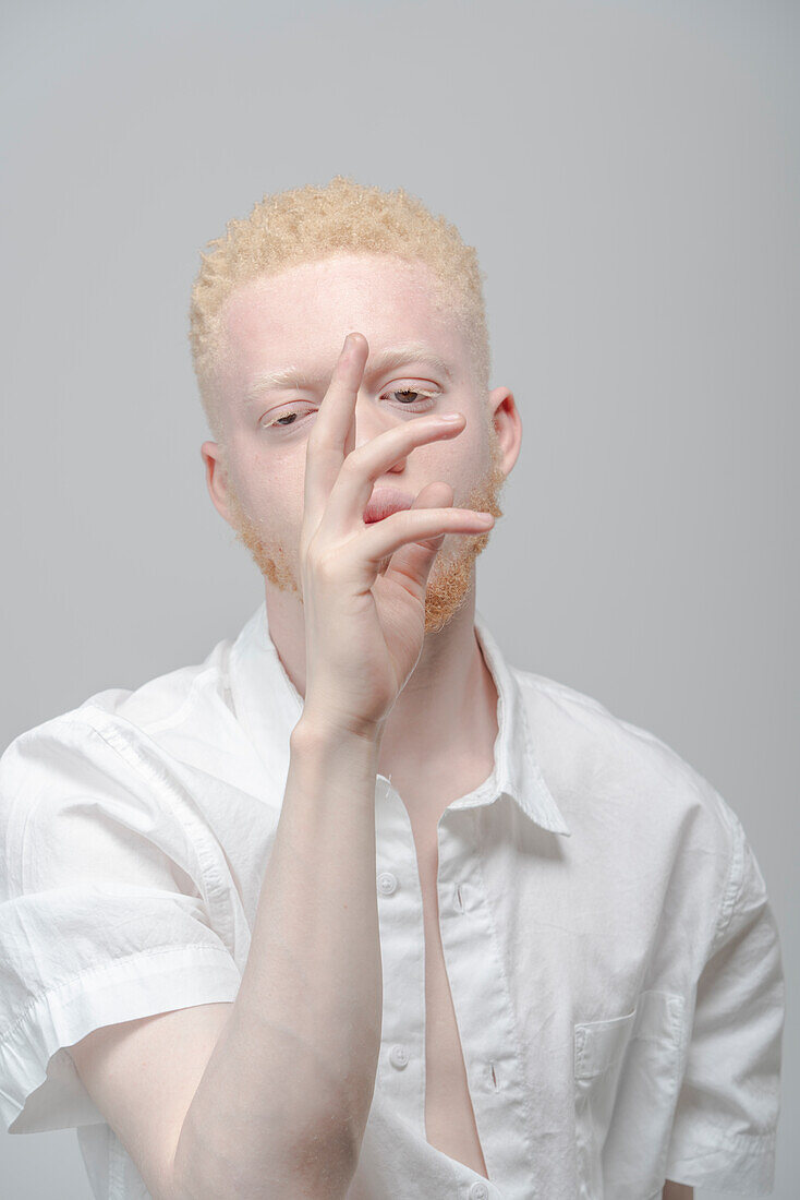 Studio portrait of albino man in white shirt