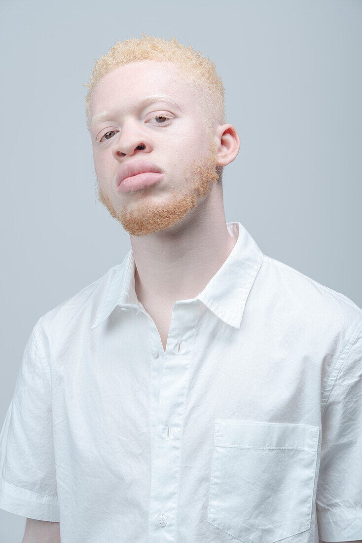 Studio portrait of albino man in white shirt