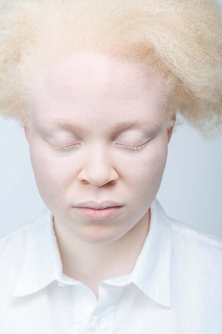 Nahaufnahme einer Albino-Frau mit geschlossenen Augen