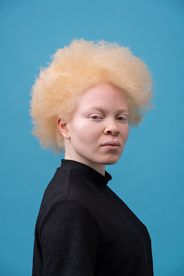 Studio-Porträt einer Albino-Frau
