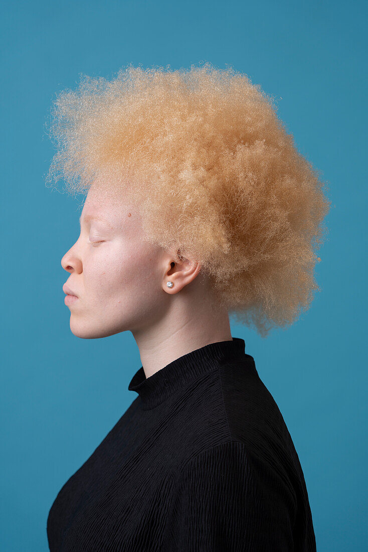 Studioporträt einer Albino-Frau mit geschlossenen Augen