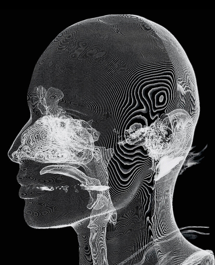 Upper airway and ear, CT scan