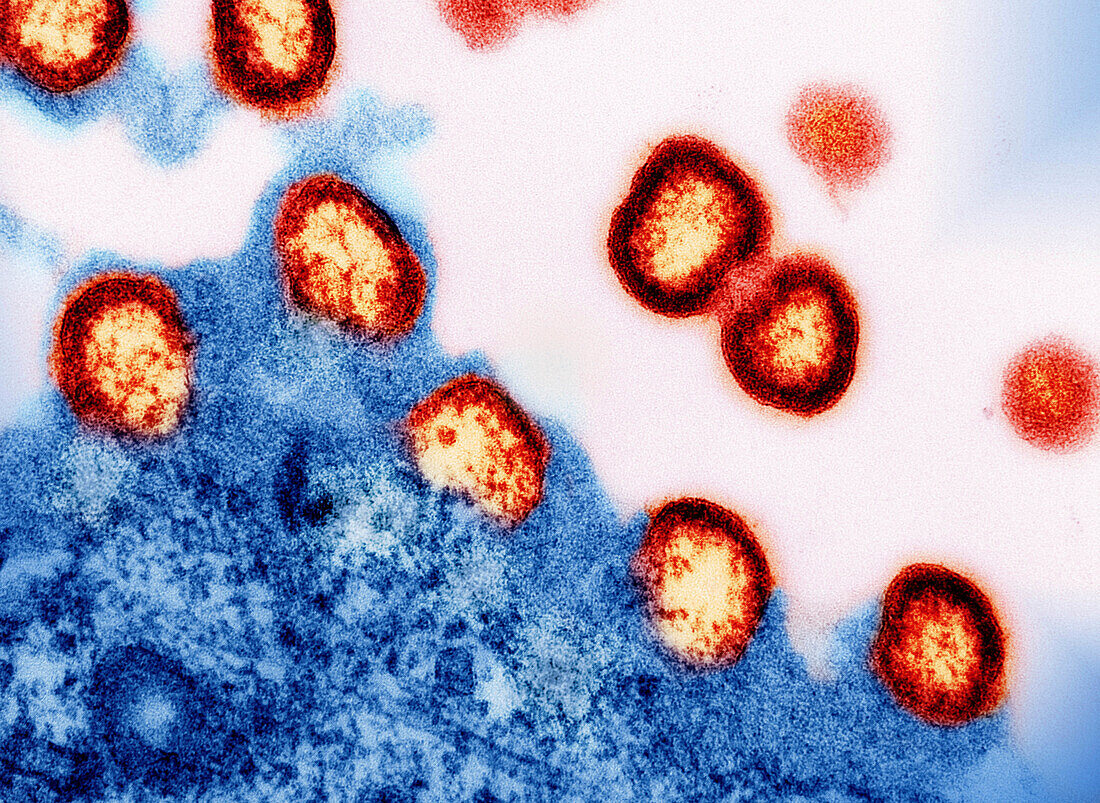 HIV-1 virus particles, TEM