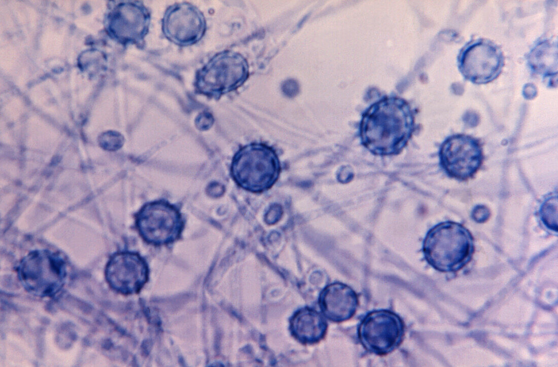 Histoplasma capsulatum fungi, light micrograph