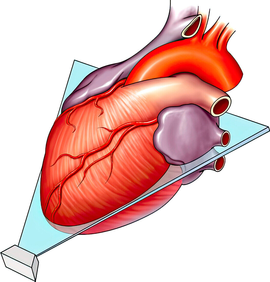 Apical plane echocardiography, illustration