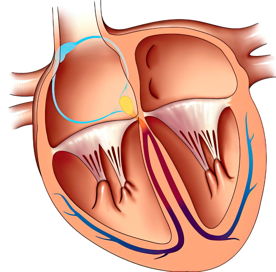 Conduction system, illustration