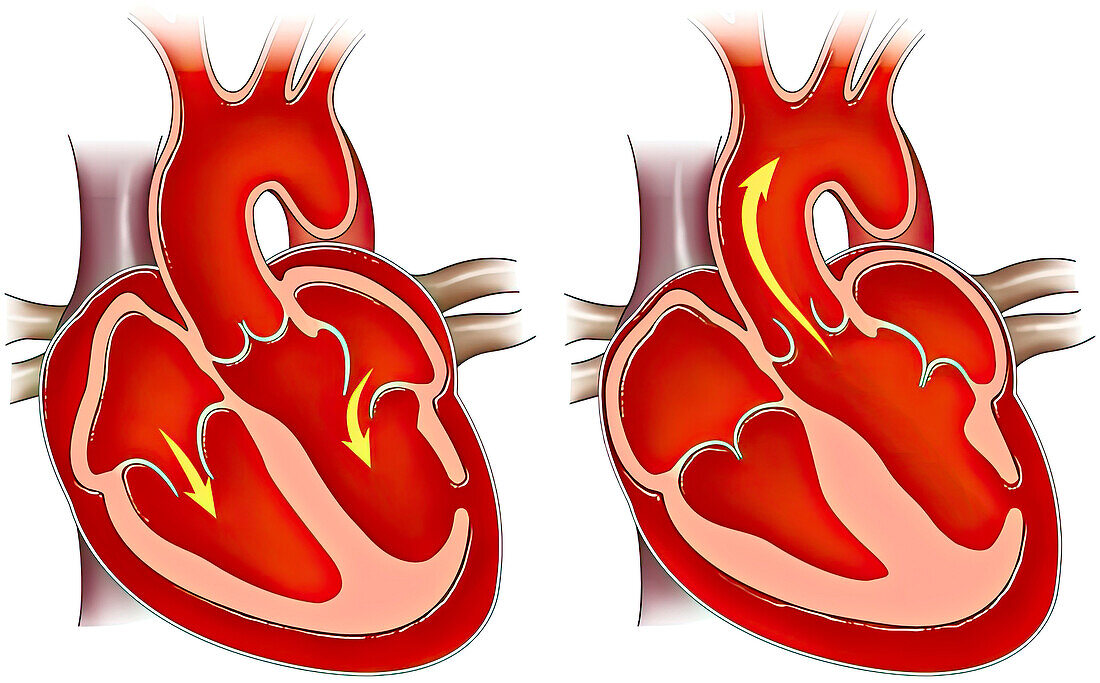 Diastole and systole, illustration